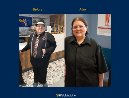 Gastric Bypass